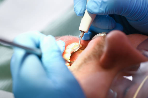 Best Emergency Dental Services for Seniors in Brookwood, AL
