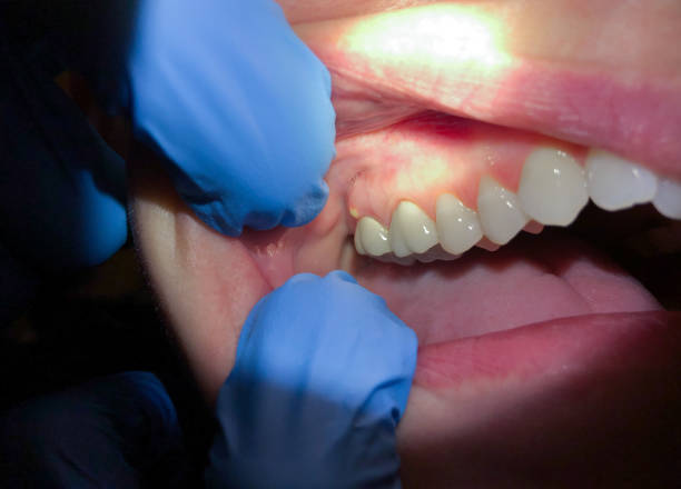 Best Mobile Emergency Dentist in Brookwood, AL